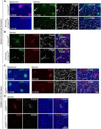 Detox and beautify your skin and hair with activated charcoal. Fate Before Function Specification Of The Hair Follicle Niche Occurs Prior To Its Formation And Is Progenitor Dependent Biorxiv