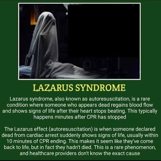 Lazarus syndrome, or auto-resuscitation, is a rare phenomenon where a  person's heart spontaneously starts beating again (Return of Spontaneous  Circulation - ROSC) after resuscitation efforts (CPR)… | Mujtaba kamal
