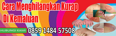 Hati hati gatal gatal di daerah kemaluan bukan saja menuju pada penyakit eksim,kurap,herpas,dermatitis dan semacamnya. Cara Menghilangkan Kurap Di Kemaluan