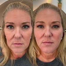 Injector Artist by Heather DeRoche