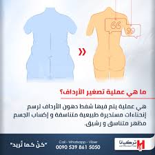 عملية تصغير الأرداف باستخدام أحدث تقنيات نحت الجسم و شفط الدهون 00905398615050 Twitter Turkeyanaclinic تركيانا زراعة الشعر في تركيا اسطنبو