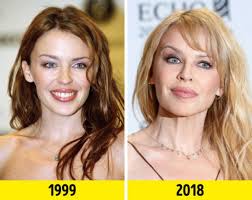 Stars Of The '90s Then And Now | Others