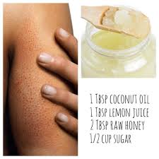 Have Kp Keratosis Pilaris Occurs When Hair Follicles Are Blocked With Built Up Keratin Causing Irritation Redn Best Body Scrub Beauty Skin Care Skin Remedies
