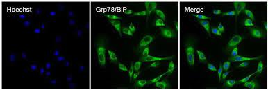Recommended for use as a negative control immunoglobulin in place of a target specific primary antibody of the same isotype (mouse igg) by if, ihc and fcm applications. Igg H L Goat Anti Rabbit Alexa Fluor 488 Superclonal 1 Mg Alexa Fluor 488 Sekundarantikorper Ziege Anti Kaninchen Fisher Scientific