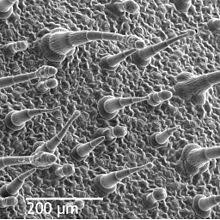Maybe you would like to learn more about one of these? Epidermis Botany Wikipedia