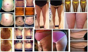 Meine Erfahrung mit Body Wraps von It Works - Fake Bilder oder  Wundermittel? • Mamizauber