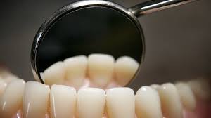 Tooth extraction can preserve and enhance your oral health. Free Dental Care Offered At Fort Myers Event This Weekend