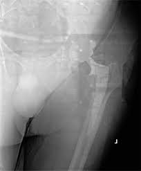 Click here to access our dr flat panel detector price guide. Pictorial Review Of Digital Radiography Artifacts Radiographics
