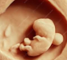 It shows my uterus, the dark shape in the middle. 6 Week Foetus 3 D Ultrasound Scan Stock Image C015 5006 Science Photo Library