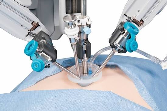 A single-center experience of over 300 cases of single-incision robotic cholecystectomy comparing the da Vinci SP with the Si/Xi systems | Scientific Reports