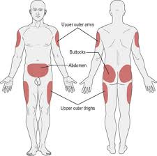 We did not find results for: 3 Management Of Diabetes Clinical Gate
