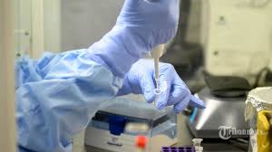 Harga Kit Dan Reagen Yang Sangat Variatif Sebabkan Biaya Rapid Test Tes Pcr Berbeda Beda Tribunnews Com Mobile