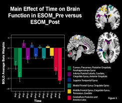 Self-Face Processing After and Before Neurofeedback in Youth with Varying  Levels of Depressive Symptoms.-2