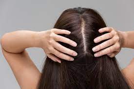 Blood flow is the number one thing in hair growth. How To Increase Blood Flow To Scalp Twogentsproductions