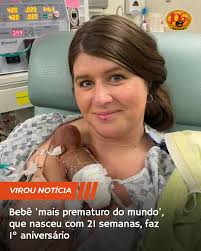 Nascido com apenas 280 gramas, de uma gestação de 21 semanas, Nash Keen  celebrou este mês seu primeiro aniversário. Conhecido como o "bebê mais  prematuro do mundo", ele entrou para o livro