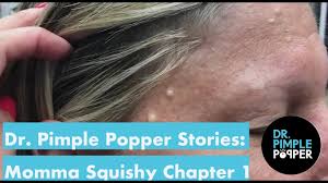 This is useful when you want to learn some kind of skills (such as languages, sports, music, etc.) by watching a specific part over and over. 25 Best Pimple Popping Videos Gross Pimple Pop Videos 2020