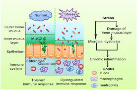 Clinical examples of acute and chronic ebv infections are discussed. Chronic Stress Promotes Colitis By Disturbing The Gut Microbiota And Triggering Immune System Response Pnas