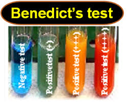 benedicts test objective principle reagents procedure