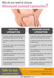 Why Do You Need To Choose Ultrasound Assisted Liposuction Talk To Our Consultant Today Dr S Krithika Ravi Liposuction Cosmetic Clinic Liposuction Procedure