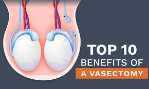 Image result for Vasectomy