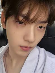 soobin selca when he got scar