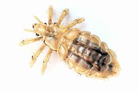 Image result for Lice