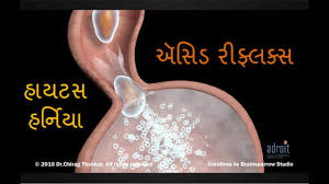 એસ ડ ર ફ લક સ એસ ડ ટ હ ય ટ સ હર ન ય અન Gerd વ શ સ પ ર ણ જ ણક ર અમદ વ દ Youtube
