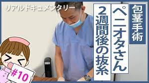 リパス増大手術】ペニオタさん、２週間後の抜糸と１ヶ月後手術 - YouTube