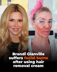 What started as a "cheap beauty trick" turned into a serious health  problem. Brandi Glanville, who is 52, known for The Real Housewives of  Beverly Hills, posted a video