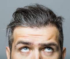 It's the chic and smart colour being embraced by more and more women. Gene Associated With Grey Hair Is Identified Parsa Mohebi Hair Restoration Hair Transplant Los Angeles And San Francisco Parsa Mohebi Hair Restoration Hair Transplant Los Angeles And San Francisco