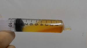 Petua hilangkan selesama via kamiboolat.blogspot.com. Ubat Batuk Semulajadi 9 1 Keluarga