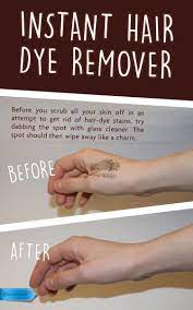 Pin On Ingenious Tips For Your House
