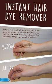 Get more information about this question how to get dye off of skin and find other details on it. Who Knew The Best Way To Get Hair Dye Off Of Your Skin Is Already Under Your Sink Savemoney Diyhome House Hair Dye Removal Warm Brown Hair Color Dyed Hair