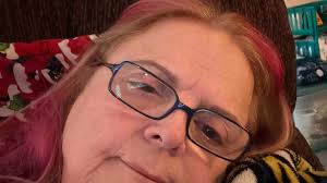 Fundraiser by Brenda Bee Boxwell Wieder : $$$ FOR NON-COVERED SURGERIES  RARE DERCUMS DISEASE