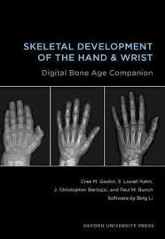 Skeletal Development Of The Hand And Wrist Digital Bone Age
