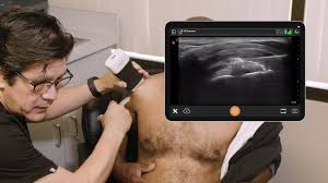 Image result for Subacromial Space Injection