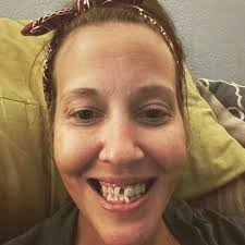 Fundraiser by June Whitehead : HELPING ME GET MY SMILE BACK!