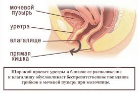 Molochnica I Cistit Prichiny Lechenie Vasha Onlajn Bolnica