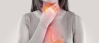 .in your esophagus work, including esophageal manometry and esophageal motility studies. Review Managing Patients With Refractory Heartburn Mpr