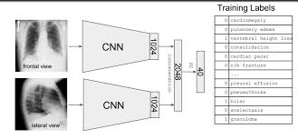 The convolution + maxpooling layers act as feature extractors from the input image while a fully connected layer acts as a classifier. How To Remove The Last Fully Connected Layer From A Cnn In Fastai To Stack More Than One Cnn Into A Fc Nn Part 1 2018 Deep Learning Course Forums