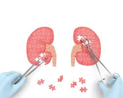 Kerusakan pada glomerulus kerusakan pada tubulus dàngagal ginjal akut penyakit ginjal progresive dan gagal ginjal kronik pada sistim pernafasan anak akan merasa sesak karena efusi pleura, selain karena distensi abdomen akibat asites tadi. Waspada Gagal Ginjal Kronik Dan Cara Penanganannya