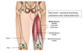 A minor strain (tear) may heal on its own, while a rupture may require surgery. Proximal Hamstring Tendinopathy Ultrasound Guided Injections