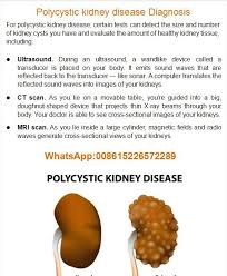 Polycystic Kidney Disease Diagnosis Pkd Polycystickidneydisease Polycystic Kidney Disease Polycystic Kidney Disease Kidney Disease Kidney Disease Symptoms