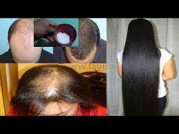 This ferment is obtained from the decomposing gluten of barley, which once acquired is used as an alternative to stimulate natural hair growth and to replace other vitamin deficiencies. Stop Hair Loss Hair Fall With This Magical Yeast Based Hair Mask Works 100 Youtube