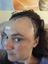 Fundraiser for Nicole Rome by Shelia Kramer : Help Nicole Rome Fight Cancer!