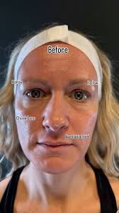 Dr. Dan Hatch, Dr. Jared Hatch, Dentistry and Medical Spa  (@allinonedental_aesthetics) • Instagram photos and videos