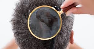 This is because the hair follicles struggle to fit through the pore and. What Causes Ingrown Hairs