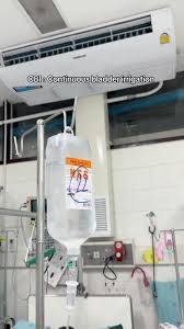 Image result for Continuous Bladder Irrigation