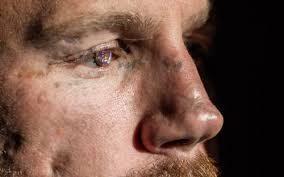 Rebuilding Honor: How Kyle Carpenter Came Back From The Brink Of Death