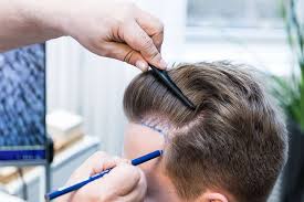 Sakal Ekimi Hair Budapest Clinic